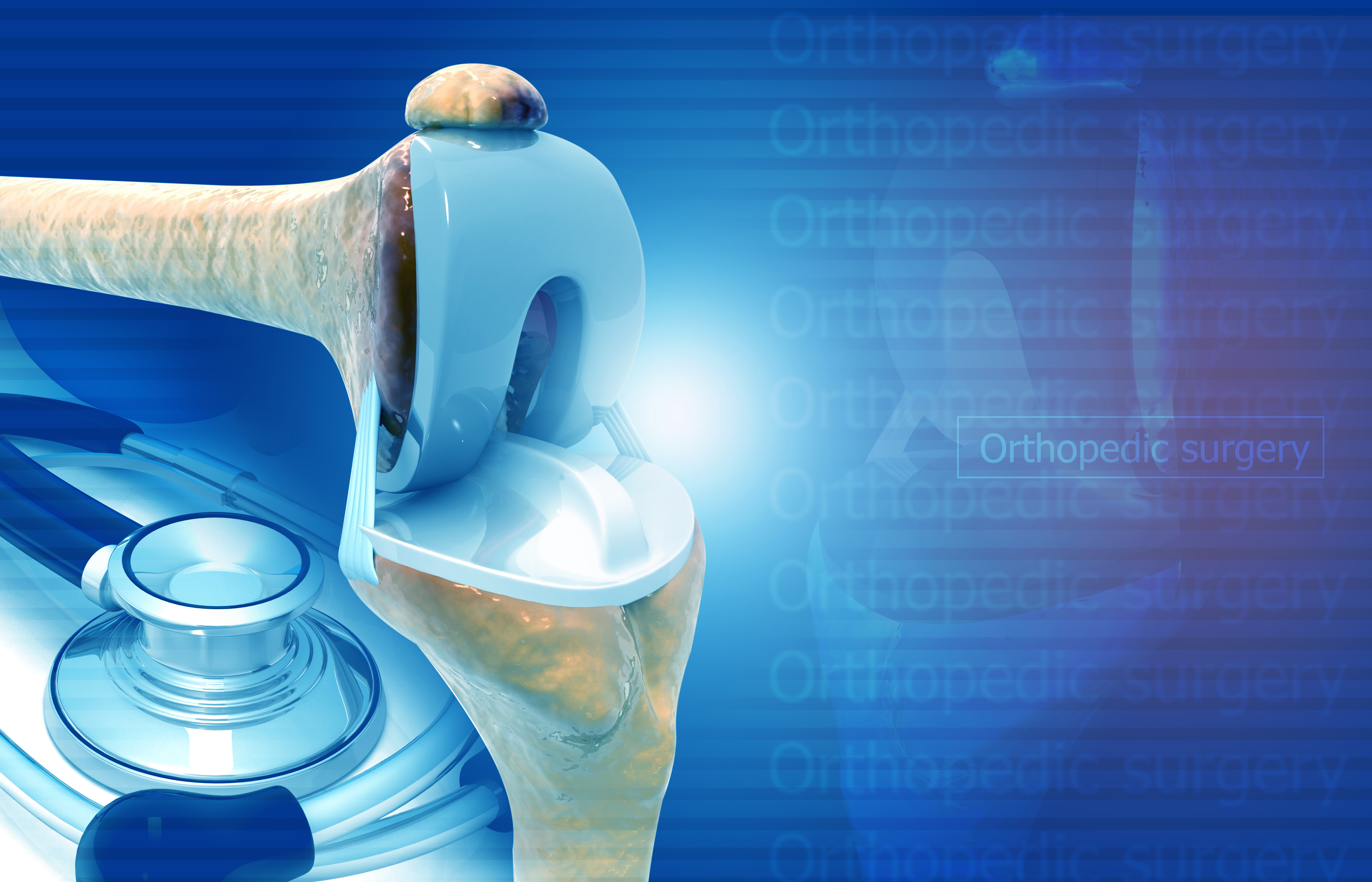 Are You Tracking Joint Replacement Revisions? If not, here’s why you should.